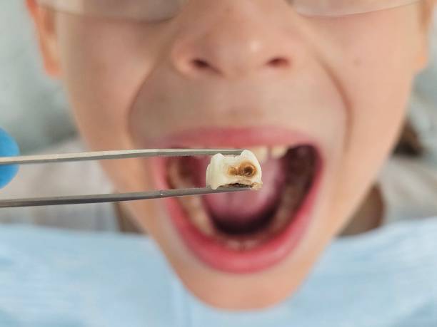 Best Holiday Emergency Dentist in Secy, AR